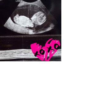 Lorraine profile icon