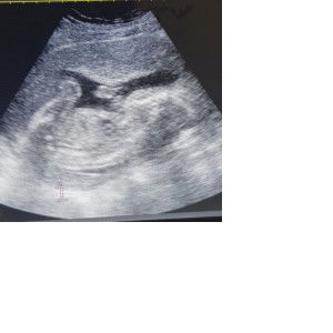 1stym mom profile icon