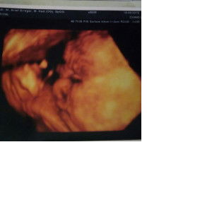 Dian Nur Syafitri profile icon