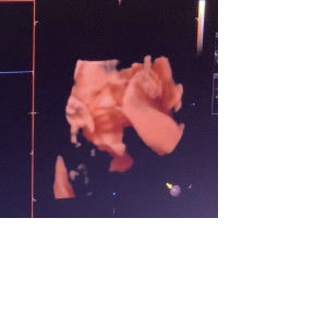 Chinatthita Yotsirihiran profile icon