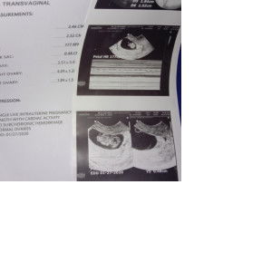 Jia Grace Canãda Torres profile icon