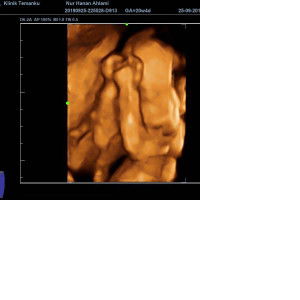 Hanan Ahlami profile icon