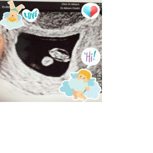 น้องของน้องกันต์ profile icon