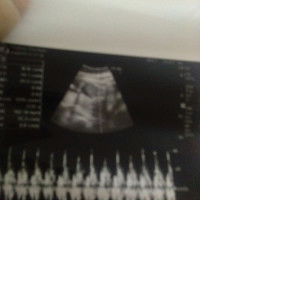 my baby profile icon