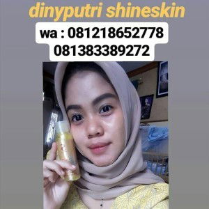 Shineskin Dini Putri profile icon