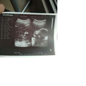 Stphn Adly profile icon