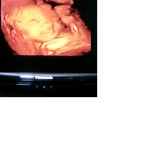 Ayu Suprihatin profile icon