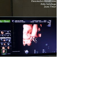 Rosika lufi yulianti profile icon