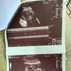 Jove-Lhyn Baybayon Loquinte profile icon