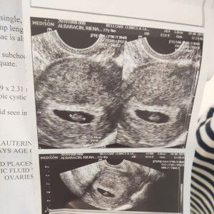 Jean Albaracin profile icon