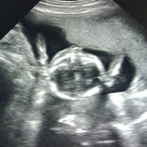 ชีวิตกำลัง จะดีขึ้น profile icon