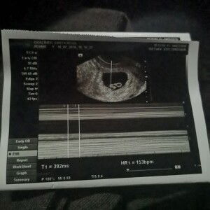 Francis Xavier John Enriquez profile icon