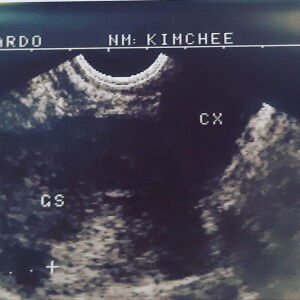 Kimchee Krystel Cuyugan Gerardo profile icon