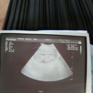 อยากให้อยู่เป็นความสับสน หรืออยากให้เป็นคนหายไป profile icon