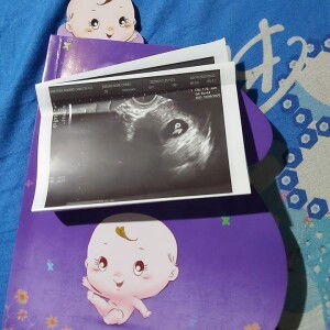 Joesan Rose Efsiaca Corea profile icon