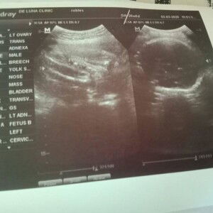 Renalyn Robles profile icon