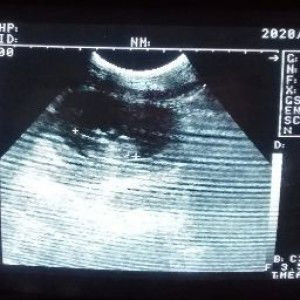 Lmae Raro profile icon