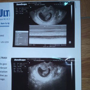 Stephanie Cuazon Paclibare profile icon