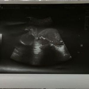 Robie Nacua Recabo profile icon