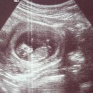 Josalyn Taguinod profile icon