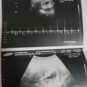 avelyn margallo profile icon