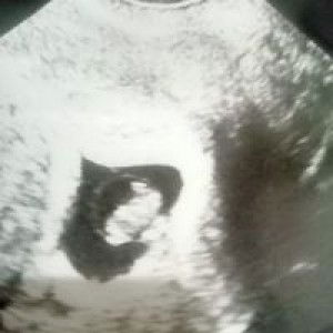 Jill Christine De Leon profile icon