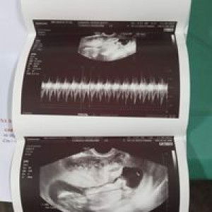 denise joyce profile icon