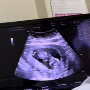 พิมพลอย หวังโซ๊ะ profile icon