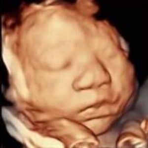 Jean Jean profile icon