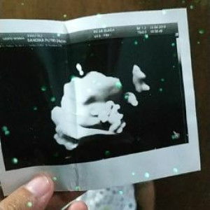 Sandika Putri profile icon