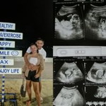 Emma Lyn Jorgel profile icon