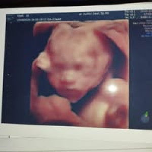 surindah Diana Apriliyati profile icon