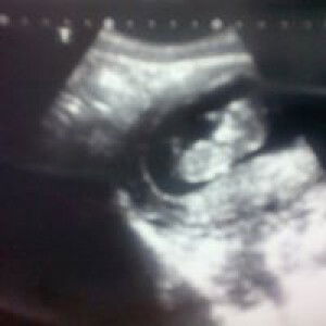 เธอ คือดวงใจของฉัน profile icon