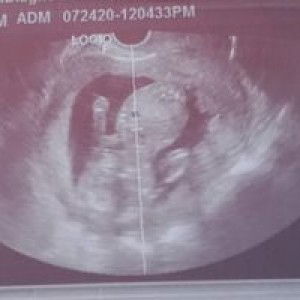 Daniella Diego Aniag profile icon