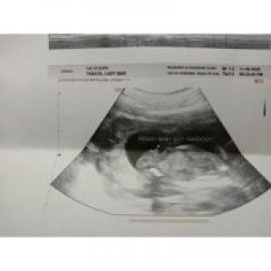 Mheckai Alcantara profile icon