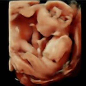 Khumairohh Dhini profile icon