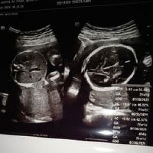 Yohanes profile icon