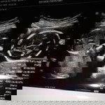 Yohanes profile icon