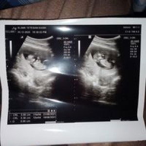 Imemey Nying Nying profile icon