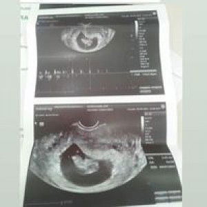 Liezel Echanes Ramos II profile icon