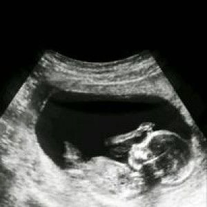 Imot Inggi Orreo Hartanto profile icon