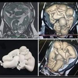 Ai Nurmalasari Irasalamrunia profile icon