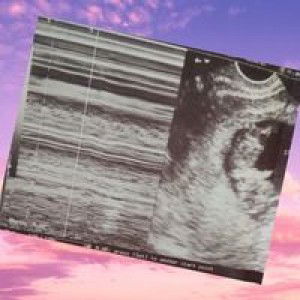 Aries Zerimar profile icon