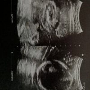 Bien Salve profile icon