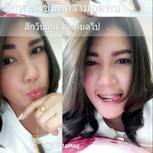 รสรินทร์ ศิริสุข profile icon