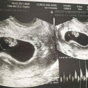 Nicole Irorita Tan profile icon