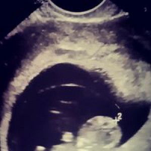 Minalyn Rejano Raminto profile icon