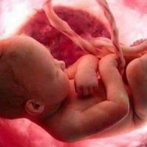 คิดถึงจัง นายแกงเขียวหวาน profile icon