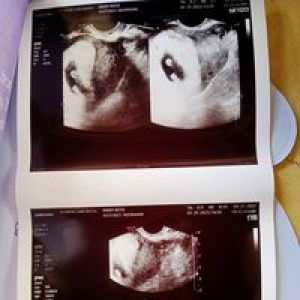 Iyhana RoseMhary Chruz profile icon