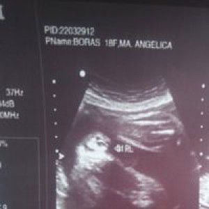 Angelica Burgos profile icon